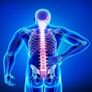 What is Cervical Fusion?