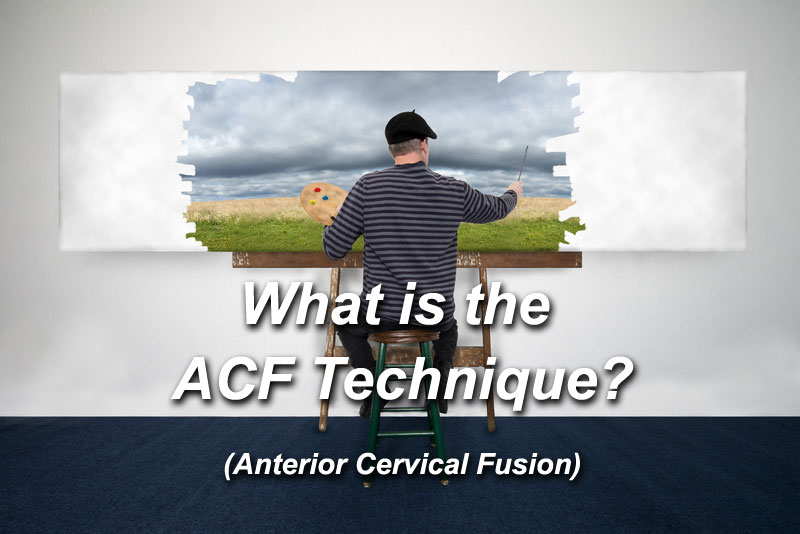 What is the ACF Technique?